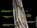 Anterior tibial artery