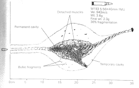 M16 5.56x45mm wound ballistics