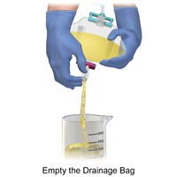 How to empty the urinary drainage bag Illustration.