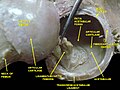 Hip joint. Lateral view. Ligament of head of femur