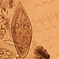 Schistosoma intercalatum