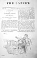 Observations on Transfusions of Blood, June 1829 issue