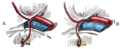 Variations in origin and course of obturator artery