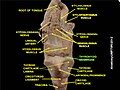 Thyrohyoid membrane