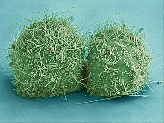 Scanning electron micrograph of just-divided HeLa cells. Zeiss Merlin HR-SEM.