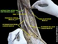 Anterior tibial artery