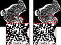 Image showing the differences between the Fastra I and the Fastra II in spatial resolution that is required to analyze changes of bone parameters