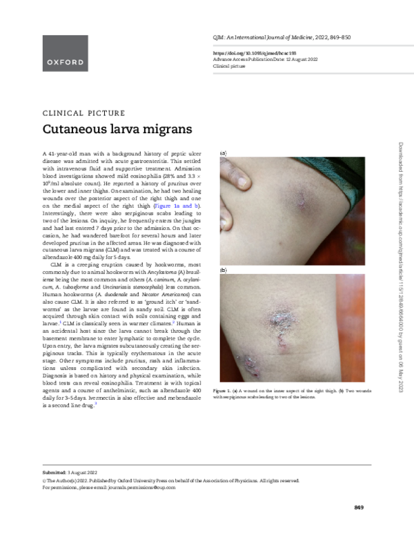 First page of “Cutaneous larva migrans”