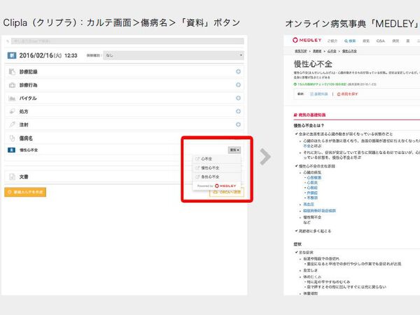 「Clipla」がもたらす患者へのメリットと、クリニックの業務効率向上に役立つAPI連携を知る