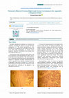 Research paper thumbnail of Metastatic Bilateral Ovarian High Grade Serous Carcinoma to the Appendix: A Diagnosis Pitfall