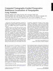 Research paper thumbnail of Computed Tomography-Guided Preoperative Radiotracer Localization of Nonpalpable Lung Nodules