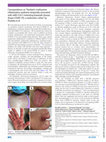 Research paper thumbnail of Correspondence on: ‘Paediatric multisystem inflammatory syndrome temporally associated with SARS-CoV-2 mimicking Kawasaki disease (Kawa-COVID-19): a multicentre cohort’ by Poulettyet al