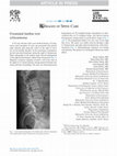 Research paper thumbnail of Foraminal lumbar root schwannoma