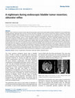 Research paper thumbnail of A nightmare during endoscopic bladder tumor resection; obturator reflex