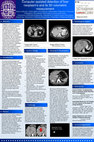 Research paper thumbnail of Computer assisted detection of liver neoplasm (CADLN)