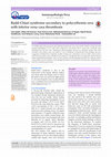 Research paper thumbnail of Budd-Chiari syndrome secondary to polycythemia vera with inferior vena cava thrombosis *Correspondence to