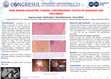 Research paper thumbnail of Rare benign esogastric tumors. Contemporary tactics of diagnosis and treatment