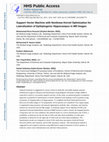 Research paper thumbnail of Support Vector Machine with nonlinear-kernel optimization for lateralization of epileptogenic hippocampus in MR images