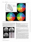 Research paper thumbnail of P998Paced QRS duration predicts the optimal LV endocardial pacing site; results from a multi-centre registry