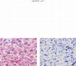 Research paper thumbnail of Supplementary Figure 4 from ADAM12 Produced by Tumor Cells Rather than Stromal Cells Accelerates Breast Tumor Progression