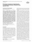 Research paper thumbnail of Processive movement of single kinesins on crowded microtubules visualized using quantum dots