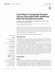 Research paper thumbnail of Case Report: Congenital Perineal Lipoma Associated With Additional External Genitalia Anomalies