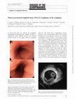 Research paper thumbnail of Mucosa-associated lymphoid tissue (MALT) lymphoma of the esophagus