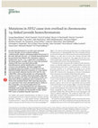 Research paper thumbnail of Mutations in HFE2 cause iron overload in chromosome 1q–linked juvenile hemochromatosis