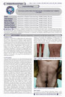 Research paper thumbnail of Sulfasalazine induced skin rash uncommon but merits caution October