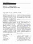 Research paper thumbnail of Sarcomatous change in the Pagetoid tibiae