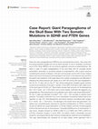 Research paper thumbnail of Case Report: Giant Paraganglioma of the Skull Base With Two Somatic Mutations in SDHB and PTEN Genes