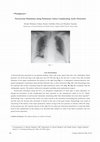 Research paper thumbnail of Perivascular Hematoma along Pulmonary Artery Complicating Aortic Dissection