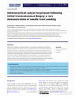 Research paper thumbnail of Adrenocortical cancer recurrence following initial transcutaneous biopsy: a rare demonstration of needle tract seeding