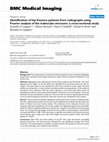 Research paper thumbnail of Identification of hip fracture patients from radiographs using Fourier analysis of the trabecular structure: a cross-sectional study