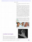 Research paper thumbnail of Localized acromegaly