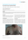 Research paper thumbnail of An unusual cause of gynaecomastia