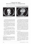 Research paper thumbnail of [Image of the month. Aortic dissection with hemopericardium]