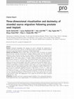 Research paper thumbnail of Three-dimensional visualization and dosimetry of stranded source migration following prostate seed implant