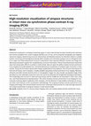 Research paper thumbnail of High-resolution visualization of airspace structures in intact mice via synchrotron phase-contrast X-ray imaging (PCXI)