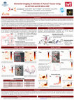 Research paper thumbnail of Elemental imaging of actinides in human tissues using LA-ICP-MS and SR micro-XRF