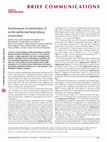 Research paper thumbnail of Involvement of interleukin-21 in the epidermal hyperplasia of psoriasis