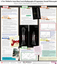 Research paper thumbnail of A New Method to Assess Bone Loss in Radiographs of Fragmentary Second Metacarpals