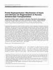 Research paper thumbnail of Portal hyperperfusion: Mechanism of injury and stimulus for regeneration in porcine small-for-size transplantation