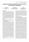 Research paper thumbnail of Quantitative Analysis of Metastasis Brain Tumor and its Area Estimation in MR Images