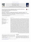 Research paper thumbnail of EEG and Neuronal Activity Topography analysis can predict effectiveness of shunt operation in idiopathic normal pressure hydrocephalus patients