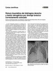 Research paper thumbnail of Rotura traumática del diafragma derecho y lesión iatrogénica por drenaje torácico correctamente colocado