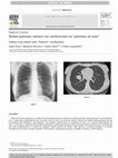 Research paper thumbnail of Nódulo pulmonar solitario con calcificaciones en “palomitas de maíz