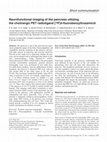 Research paper thumbnail of Neurofunctional imaging of the pancreas utilizing the cholinergic PET radioligand [ 18 F]4-fluorobenzyltrozamicol