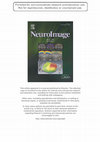 Research paper thumbnail of Movement related activity in the high gamma range of the human EEG