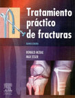 Research paper thumbnail of Tratamiento Practico de Fracturas - McRae 5ta Edicion